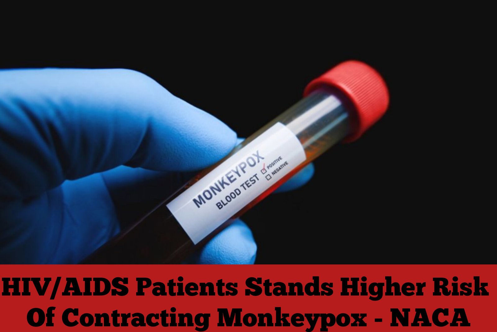 HIV/AIDS Patients Stands Higher Risk Of Contracting Monkeypox – NACA