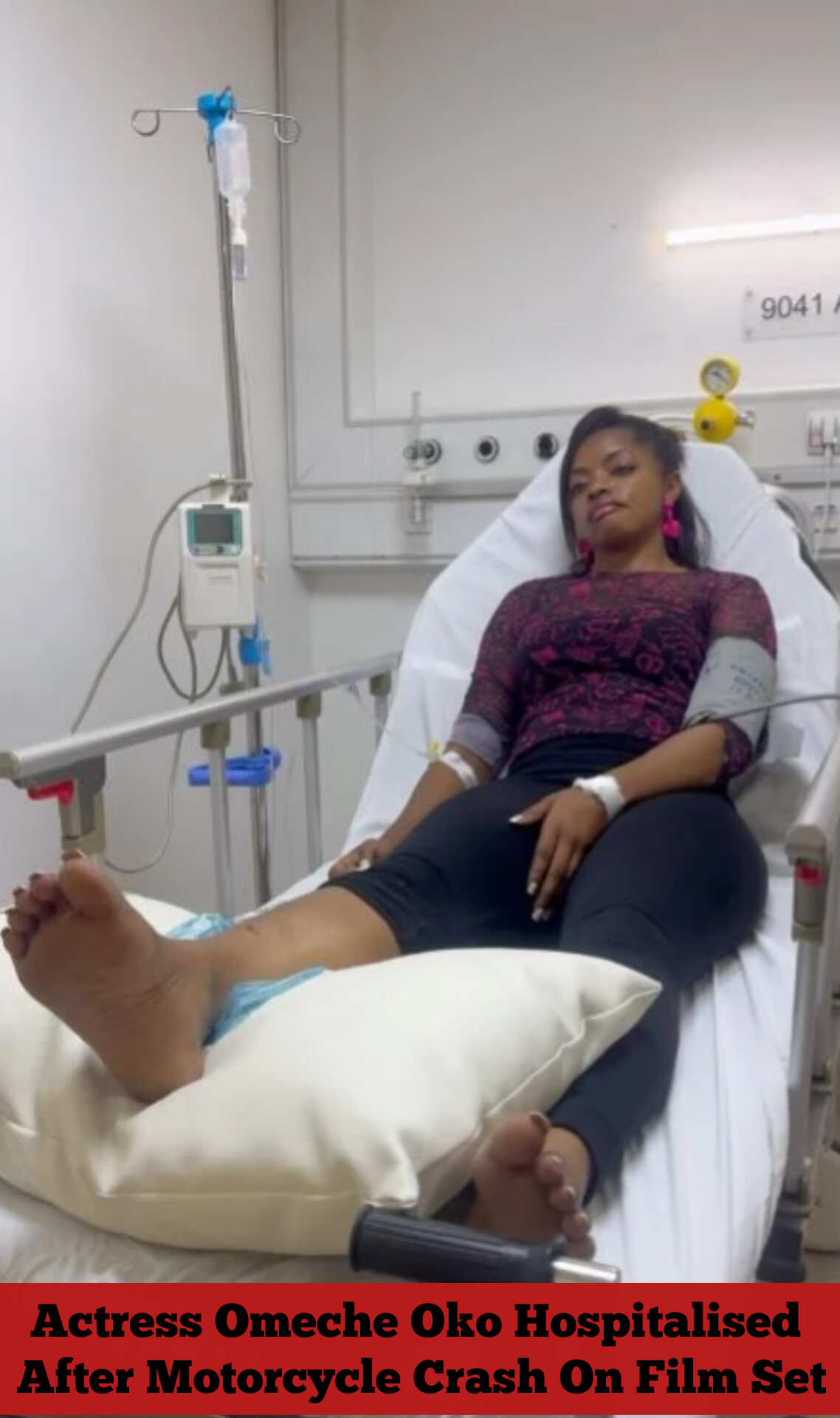 Actress Omeche Oko Hospitalised After Motorcycle Crash On Film Set